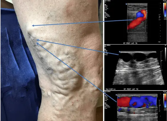 سونوگرافی کالر داپلر