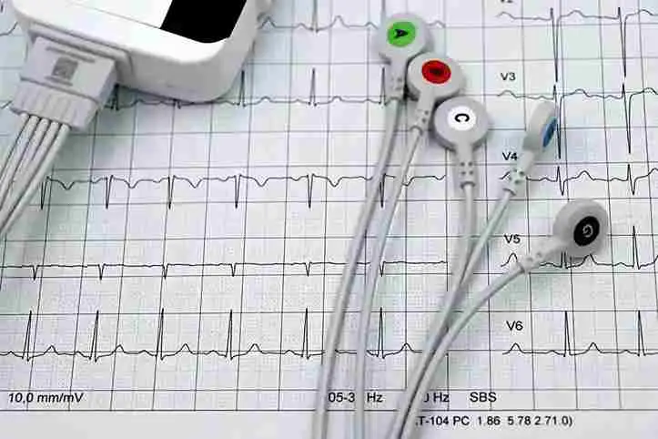 تخطيط كهربية القلب (ECG)