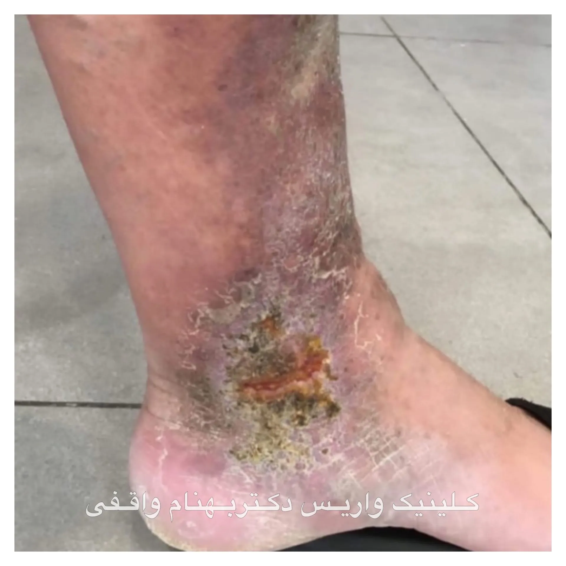 سوالات متداول واریس