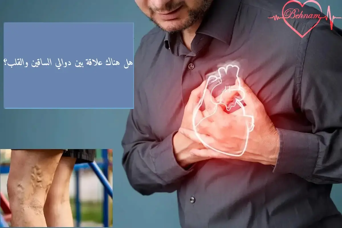 هل هناك علاقة بين دوالي الساقين والقلب؟