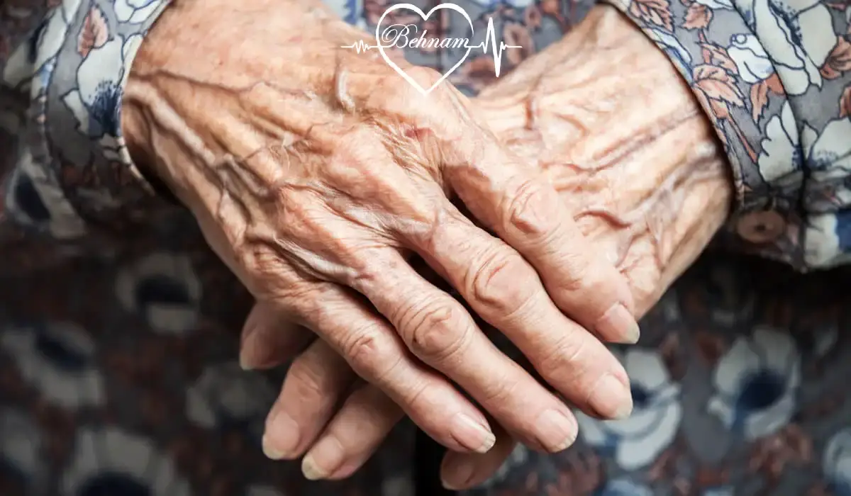 veins hand