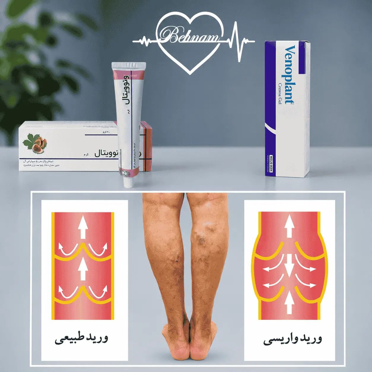 أفضل مرهم لعلاج الدوالي